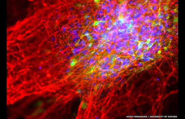 Imagem revela transformação de células da pele (tiradas de portadores de Parkinson) em neurônios em laboratório (Foto: Hugo Fernandes / University of Oxford)